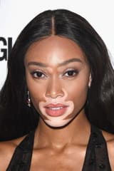 Winnie Harlow
